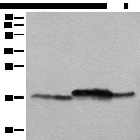 Polyclonal Rabbit anti-Human NDUFB11 Antibody (IHC, WB)
