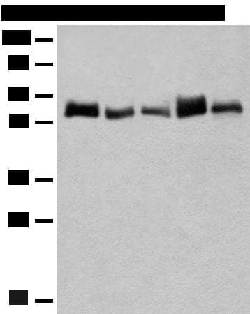 CCDC47 Antibody