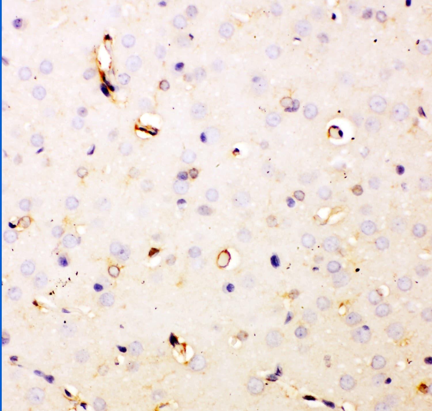 Polyclonal Rabbit anti-Human DHFR Antibody (aa2-187, IHC, WB)