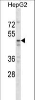 TAPBPL / TAPBPR Antibody (aa2-31)