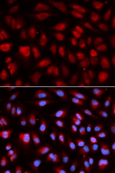 PLK1 / PLK-1 Antibody