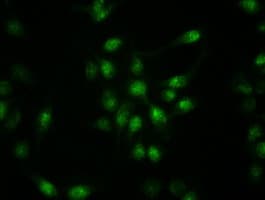 KRT19 / CK19 / Cytokeratin 19 Antibody (clone OTI5D1)