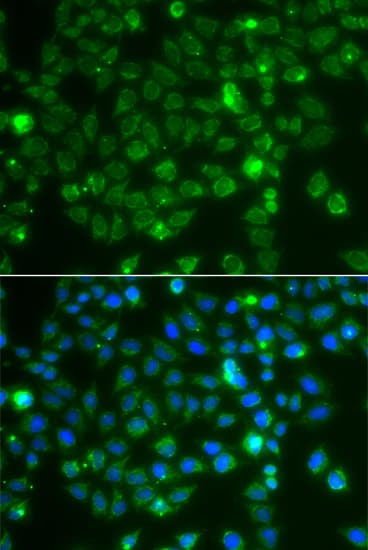 RAC1 Antibody