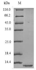 Human OX2R / Orexin Receptor 2 Protein (Recombinant 6His, N-terminus)