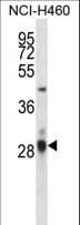 IHC-plus™ Polyclonal Rabbit anti-Human CD274 / B7-H1 / PD-L1 Antibody (aa261-290, IHC, WB)