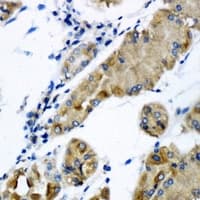 Polyclonal Rabbit anti-Human CHMP2B Antibody (IHC, IF, WB)
