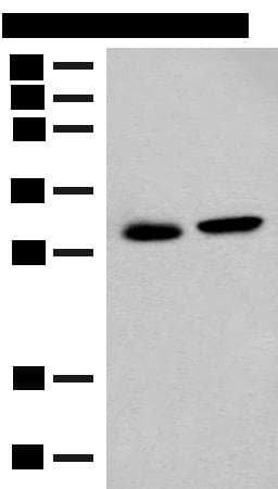 GLYAT Antibody