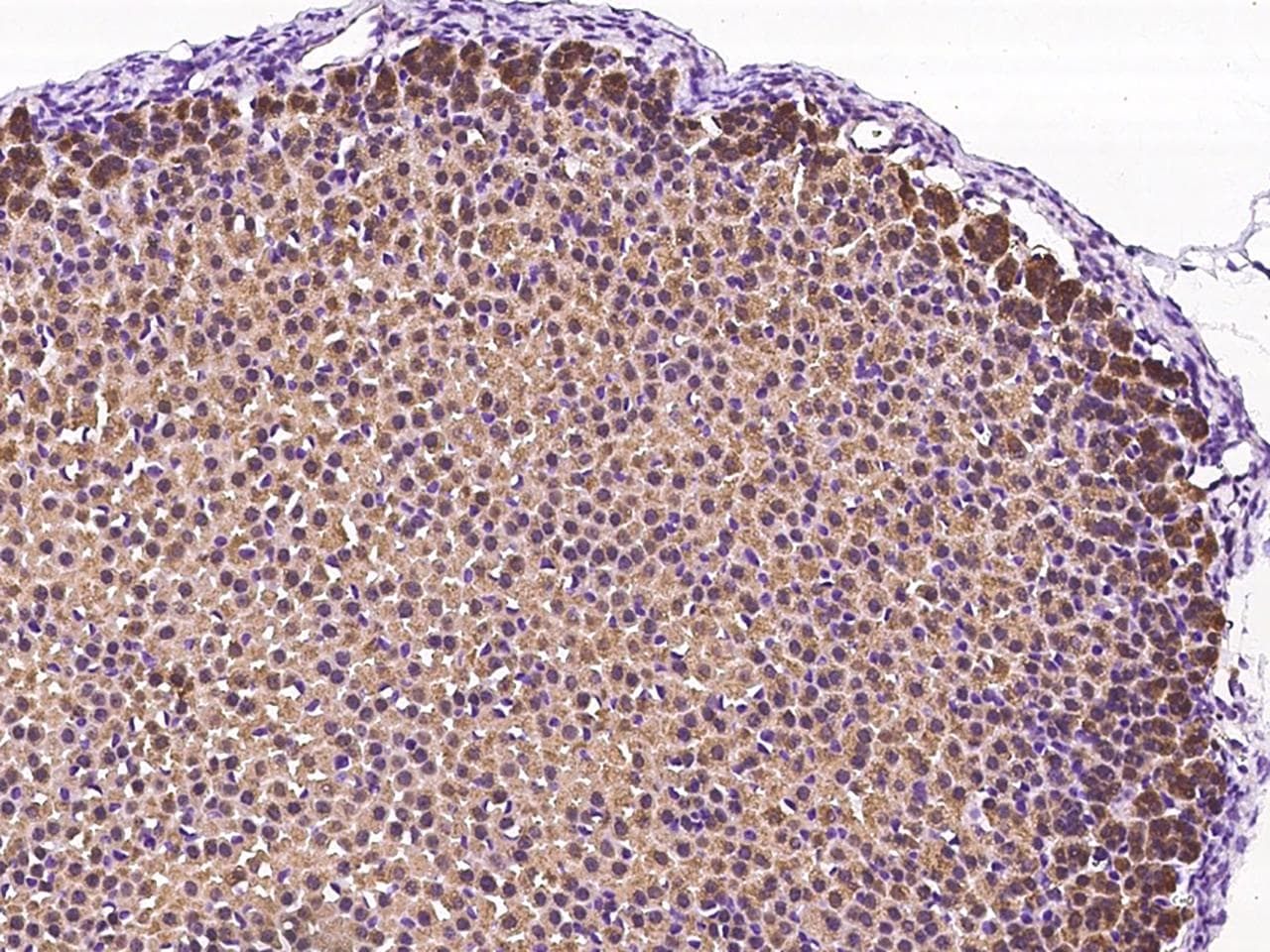 GDF3 Antibody