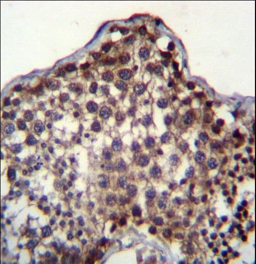 Polyclonal Rabbit anti-Human PQLC2 Antibody (aa222-251, IHC, WB)
