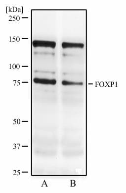 FOXP1 Antibody (clone JC12)