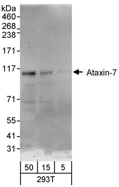 ATXN7 / SCA7 / Ataxin-7 Antibody (aa842-892)
