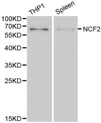 Polyclonal Rabbit anti-Human NCF2 / NOXA2 / p67phox Antibody (IHC, WB)