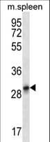 KRT222 / Keratin 222 Antibody (aa222-250)