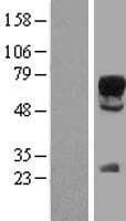 Human SOX9 Protein (Over-Expression Lysate Myc-DDK (Flag))
