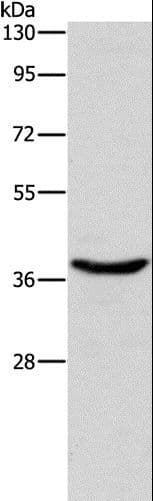 HSP40 Antibody