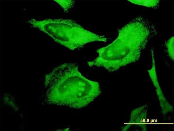 PROCR / EPCR Antibody (clone M2)