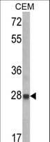 IGFBP6 Antibody (aa176-200)