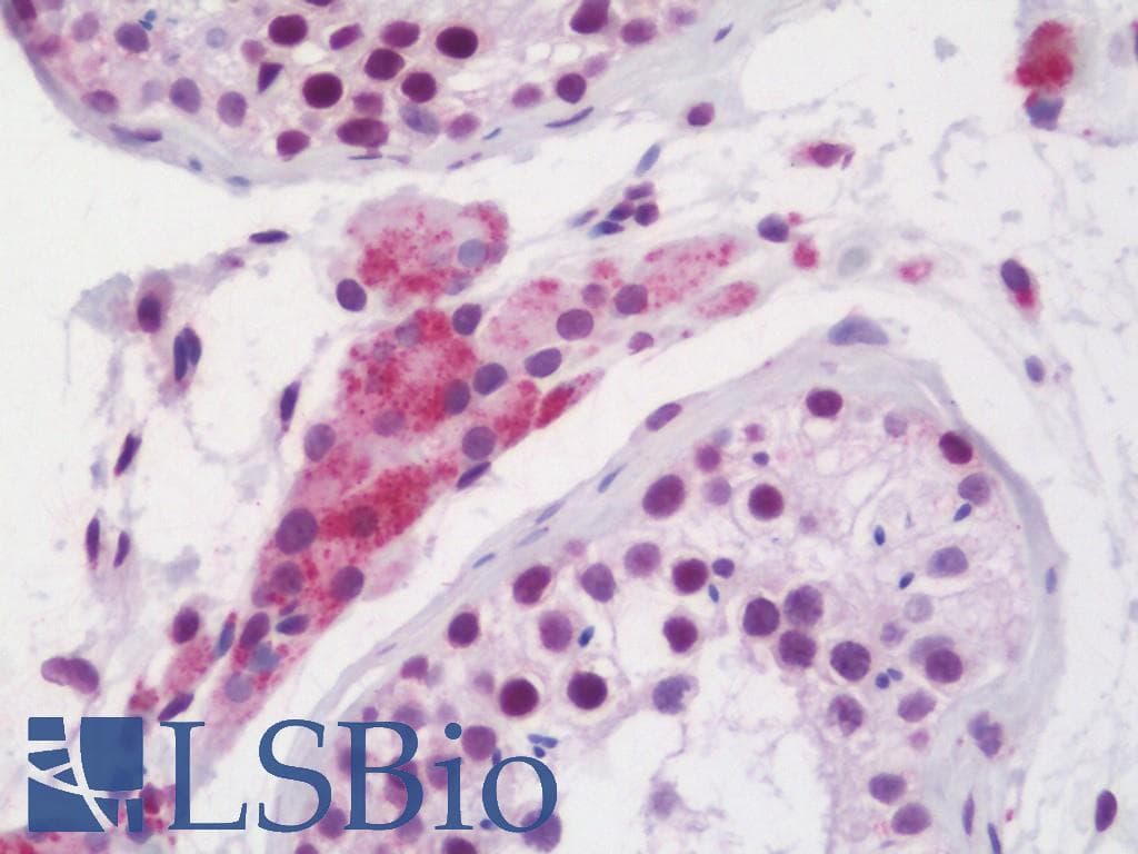 IHC-plus™ RXTA / RXR-Alpha Antibody (aa196-224)