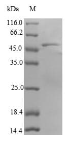 Human RAB18 Protein (Recombinant GST, N-terminus)