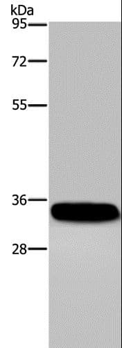 CA4 / Carbonic Anhydrase IV Antibody