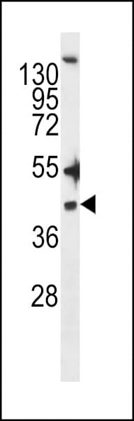 Polyclonal Rabbit anti-Human ZDHHC20 Antibody (aa26-54, IHC, WB)