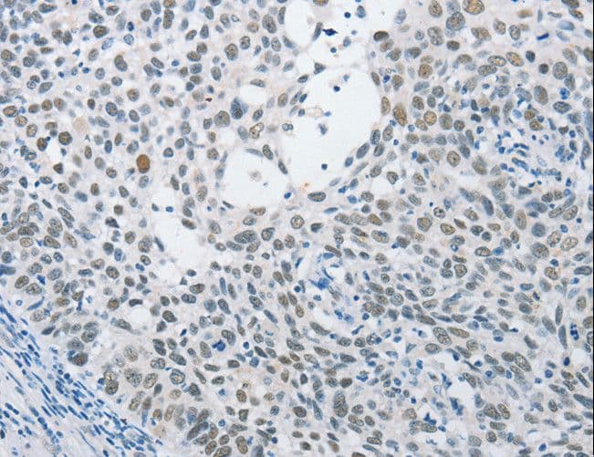 Polyclonal Rabbit anti-Human SAE1 Antibody (IHC, WB)