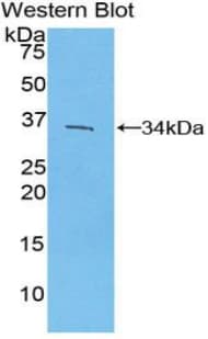 MUM1 Antibody (aa175-433)