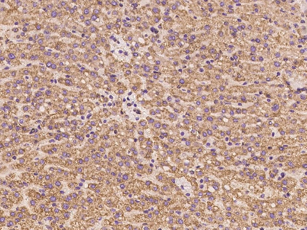 Polyclonal Rabbit anti-Human ABCC11 / MRP8 Antibody (IHC)