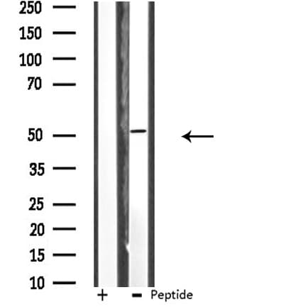 RRP8 Antibody