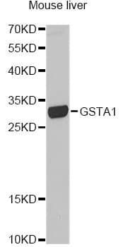 Polyclonal Rabbit anti-Human GSTA1 Antibody (IHC, WB)