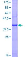 Human ITGAD / CD11d Protein (Recombinant GST, N-terminus)