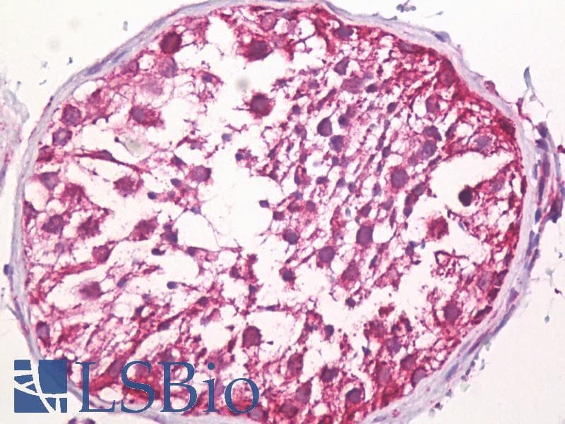 IHC-plus™ GC1qR / C1QBP Antibody (aa61-110)