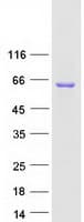 Human RBM47 Protein (Recombinant Myc-DDK (Flag))