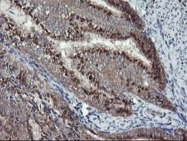 DPH2 Antibody (clone OTI4E7)