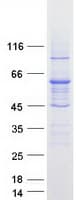 Human ABCD4 Protein (Recombinant Myc-DDK (Flag))