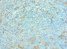 Polyclonal Rabbit anti-Human G3BP1 / G3BP Antibody (aa227-466, IHC, WB)