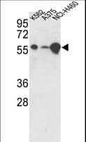 USP3 / UBP Antibody (aa489-519)