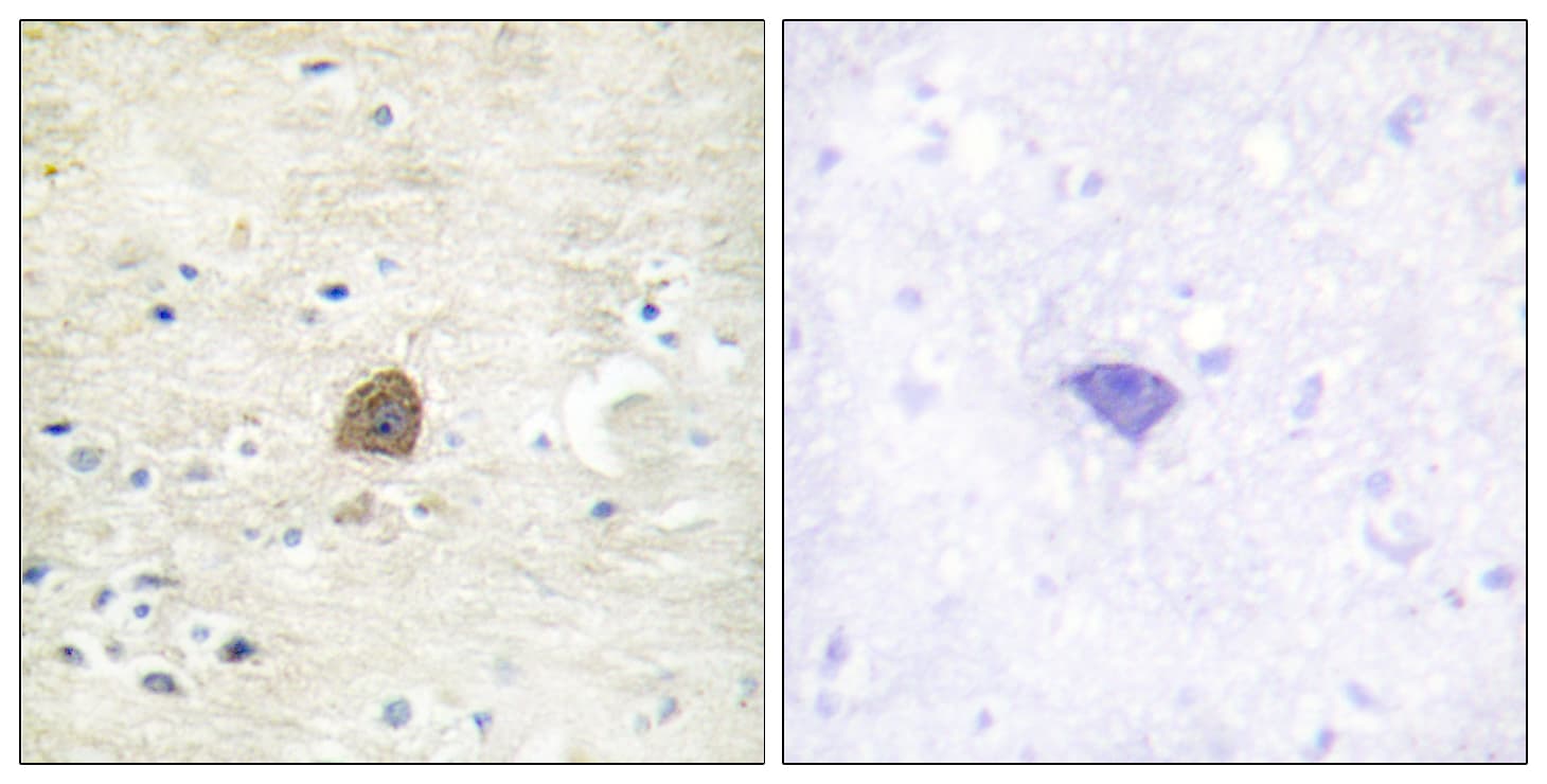 Polyclonal Rabbit anti-Human CaMKII Alpha+Beta+Delta Antibody (phospho-Thr305, IHC, WB)