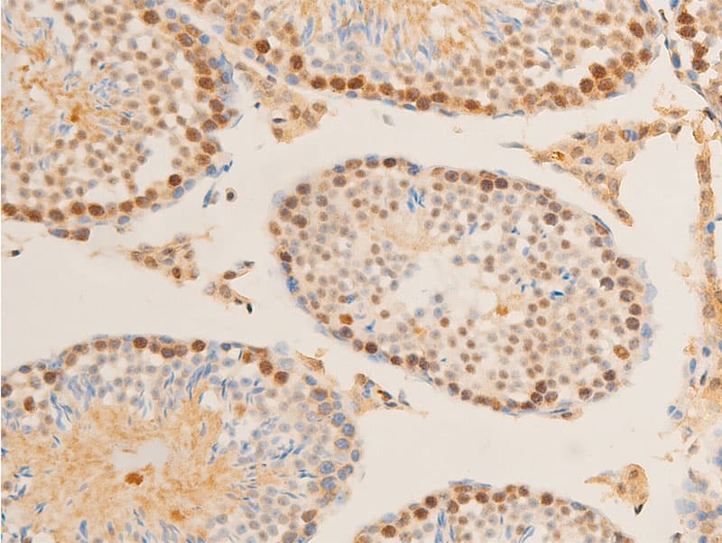 Polyclonal Rabbit anti-Human MYC / c-Myc Antibody (phospho-Ser62, IHC, IF, WB)