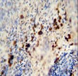 Polyclonal Rabbit anti-Human LCE1A Antibody (aa54-83, IHC, WB)