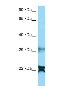 Polyclonal Rabbit anti-Human NDUFA8 Antibody (aa25-74, WB)