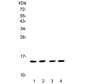 Polyclonal Rabbit anti-Human E-FABP / FABP5 Antibody (IHC, WB)