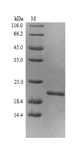 Escherichia coli EF-P Protein (Recombinant 6His, N-terminus)