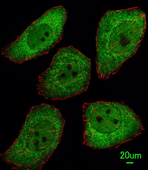 Securin / PTTG1 Antibody (aa16-45)