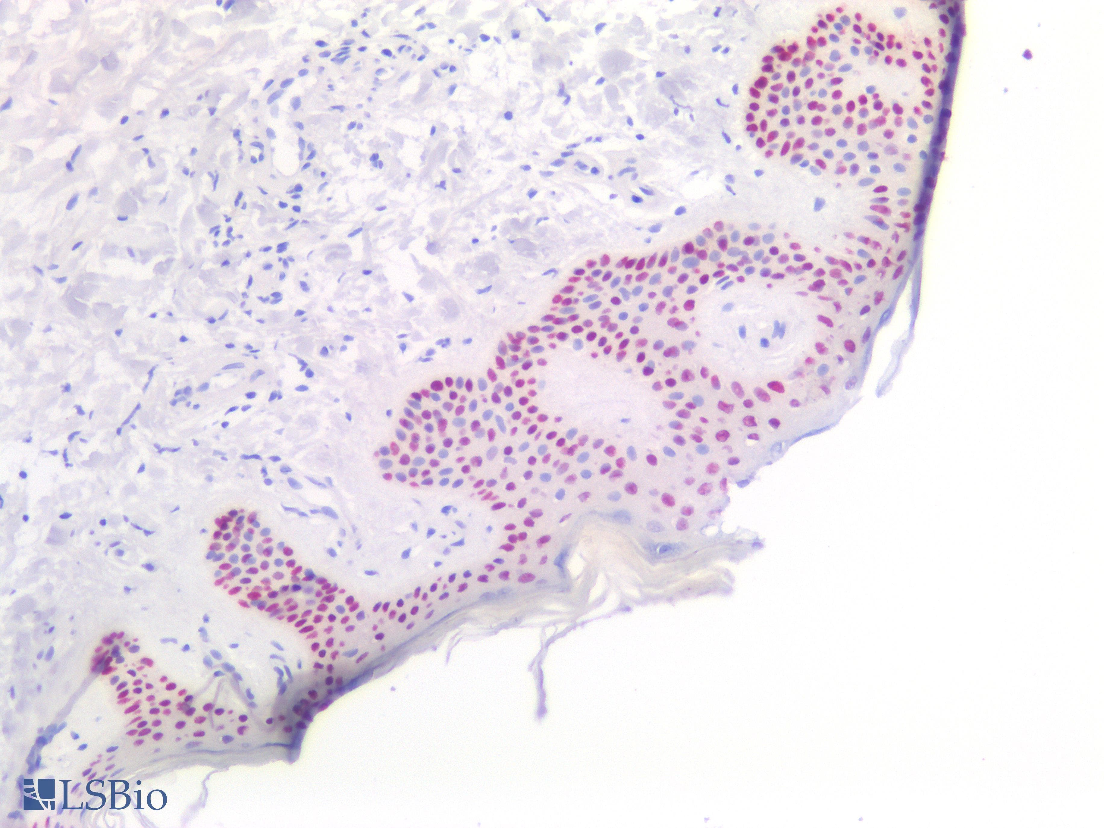 PathPlus™ Monoclonal Mouse anti-Human TP63 / p63 Antibody (IHC, WB)