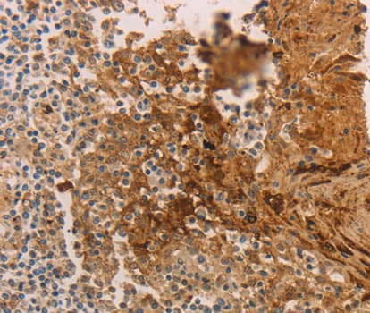 ADCYAP1R1 / PAC1 Receptor Antibody