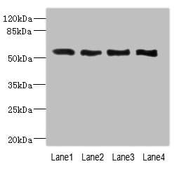 Polyclonal Rabbit anti-Human VANGL2 / LTAP Antibody (IHC, WB)