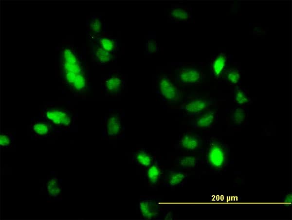 IHC-plus™ Monoclonal Mouse anti-Human UBCH10 / UBE2C Antibody (clone 9D3, IHC, IF, WB)