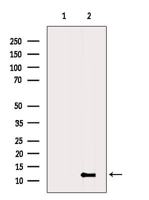 ATPIF1 / ATPI Antibody