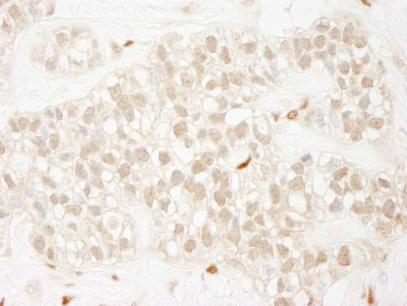 Polyclonal Rabbit anti-Human ZEB1 / AREB6 Antibody (aa1074-1124, IHC)